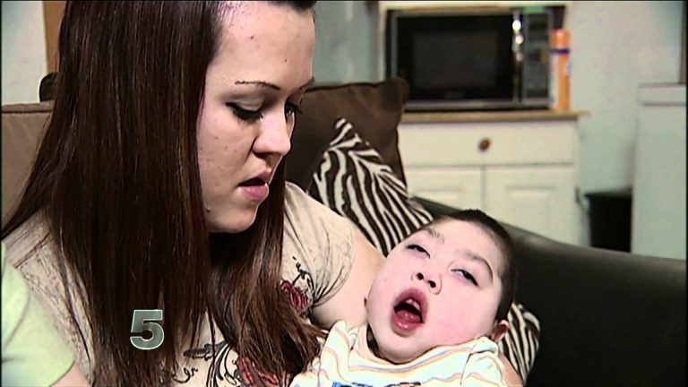 baby_born_without_a_brain