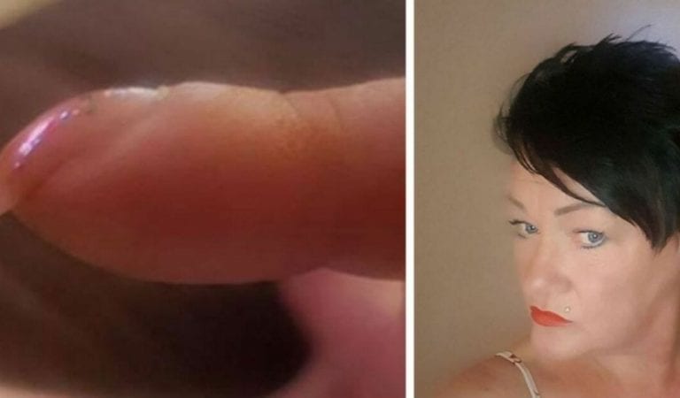 Mom posts picture of her nails on Facebook..gets immediate message telling her to seek medical help Mom posts picture of her nails on Facebook..gets immediate message telling her to seek medical help