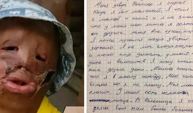 “Santa Can I Have A New Face For Christmas”..gut-wrenching letter from little boy “Santa Can I Have A New Face For Christmas”..gut-wrenching letter from little boy