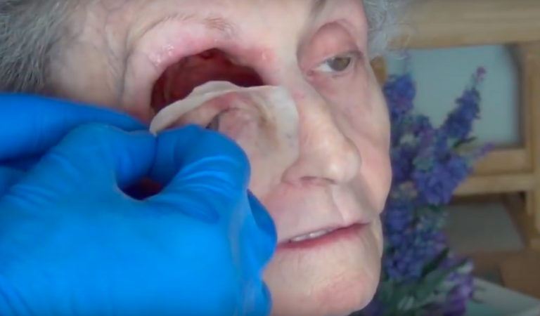 Wow!!Watch as They Remove Eye With Bare Hands Wow!!Watch as They Remove Eye With Bare Hands