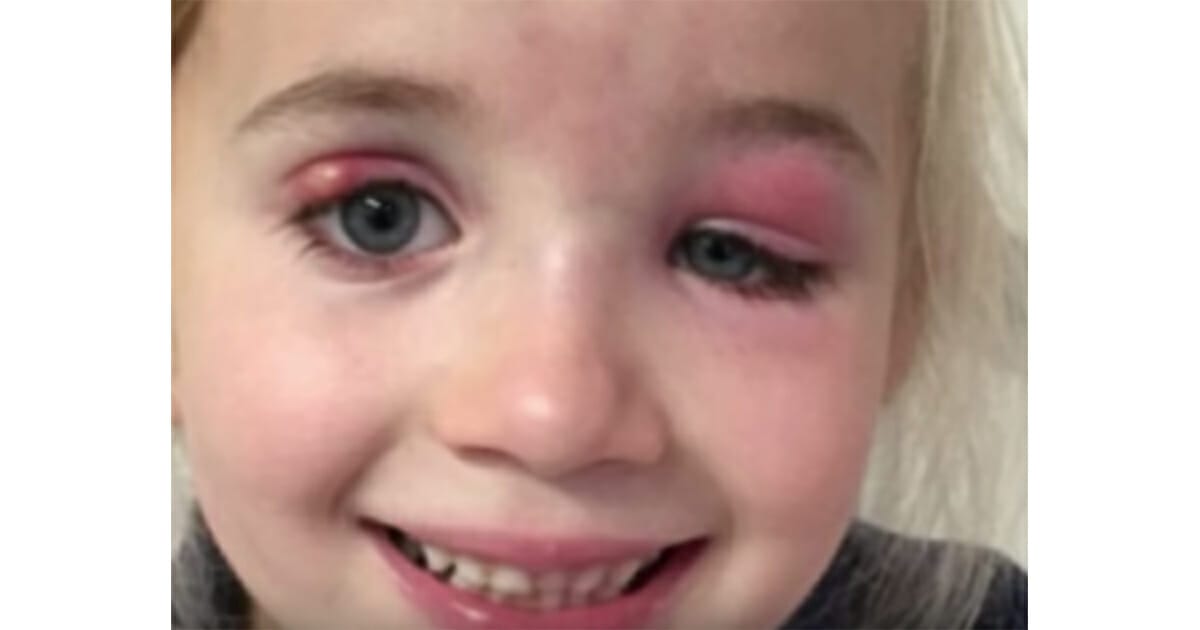 dr-insisted-little-girl-only-has-an-eye-infection-mom-knows-she-will