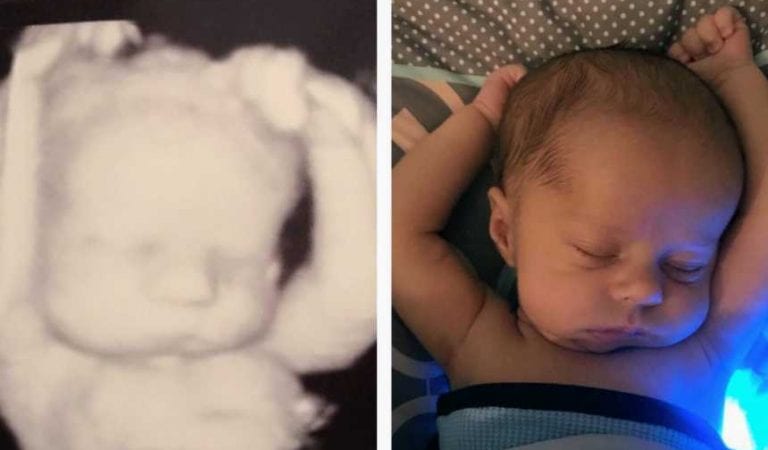 Weeks after birth, mom compares ultrasound photo and puts together something she missed Weeks after birth, mom compares ultrasound photo and puts together something she missed