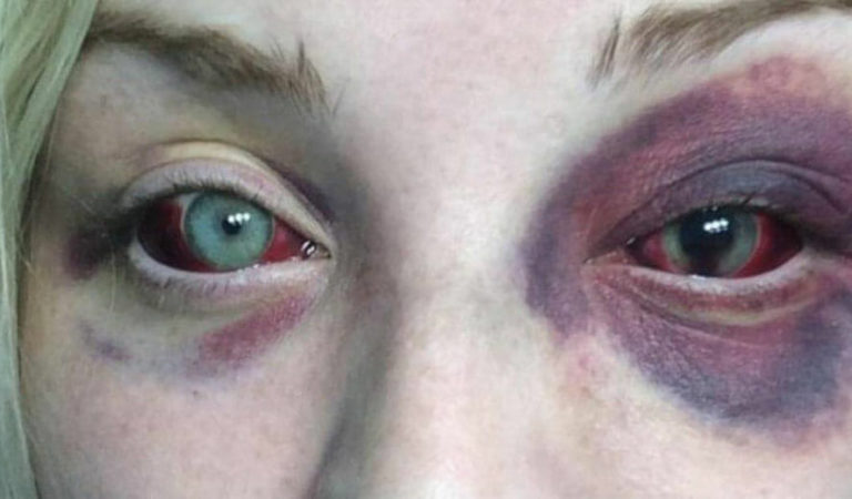 I’m a Dad–this is what my daughters abusive boyfriend did to my baby girl I’m a Dad–this is what my daughters abusive boyfriend did to my baby girl